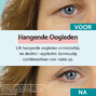 Remescar Hangende Oogleden Crème 8ML 67326